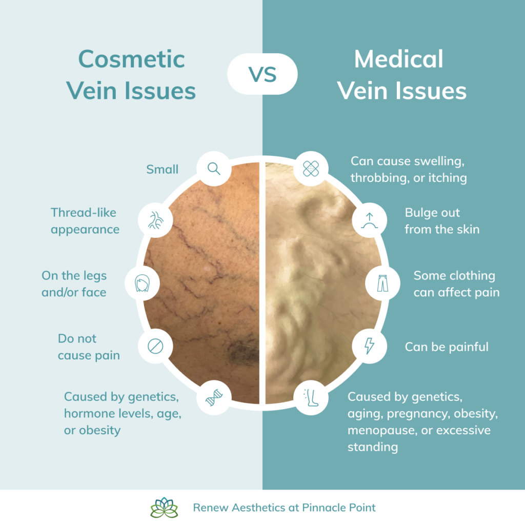 infographic on medical verses cosmetic vein issues