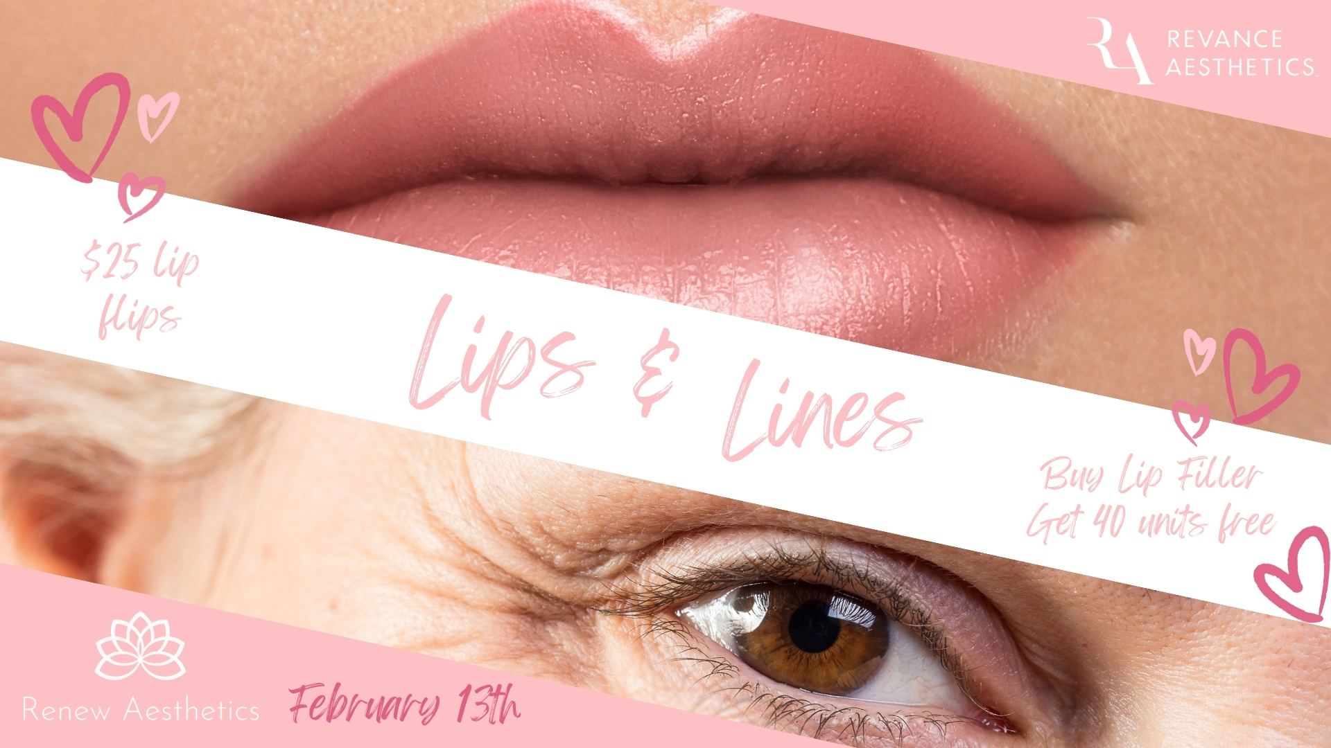 Lips & Lines Event medspa